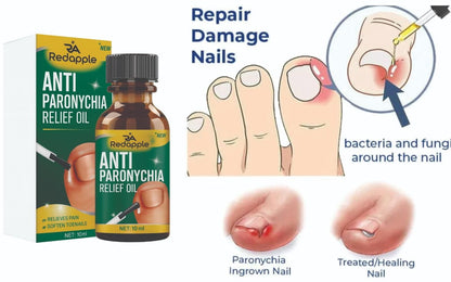 Rapid Relief Anti-Paronychia Nail Treatment Oil (20ml x 2) | Soothing Cuticle & Nail Infection Care